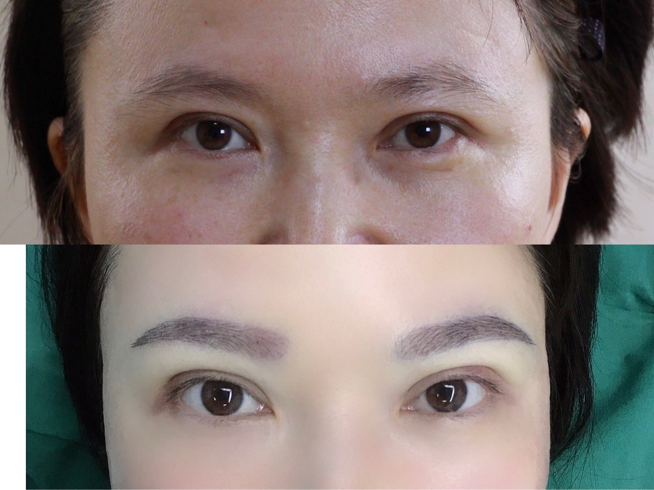 植眉经历分享：眉毛种植术后15天效果 - 知乎