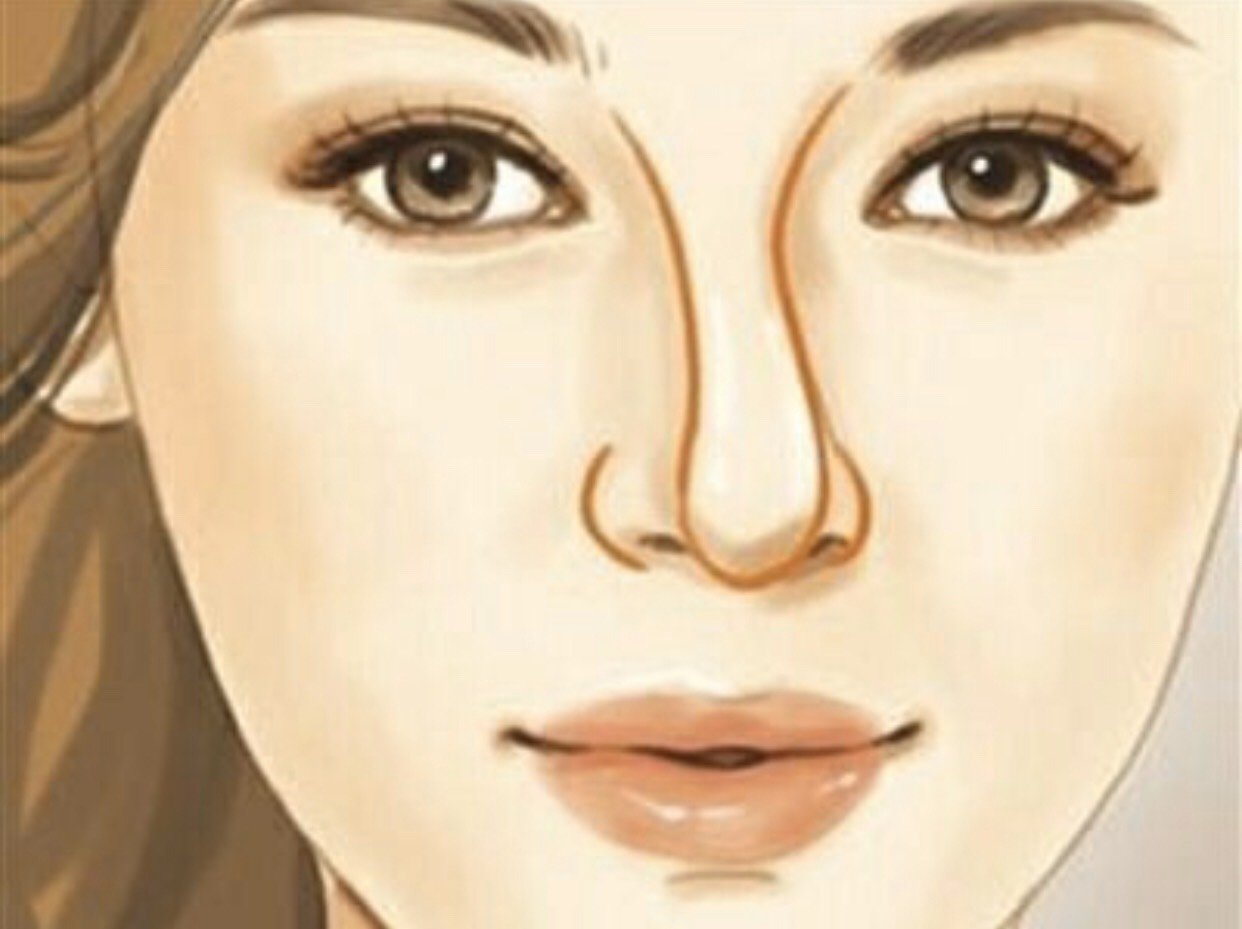 歪鼻要如何矫正?