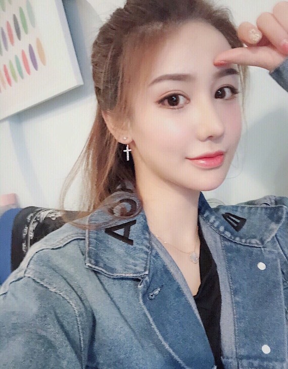 【肋骨鼻反馈】肋骨鼻修复,这已经是第三次做了,疤痕_圈子-新氧美容