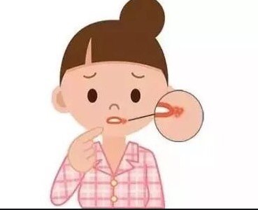 【宝宝烂嘴角可能是口角炎】