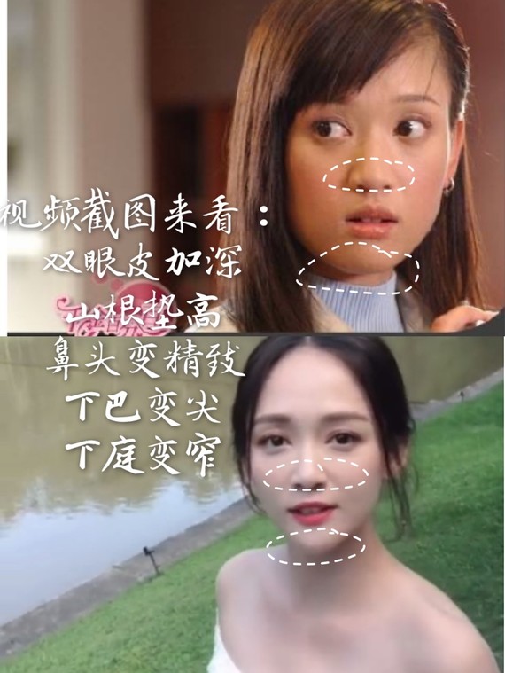 909090陈乔恩基本上可_圈子-新氧美容整形