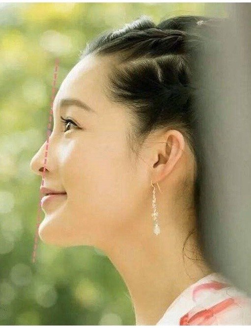 杨幂的拔牙瘦脸_圈子-新氧美容整形