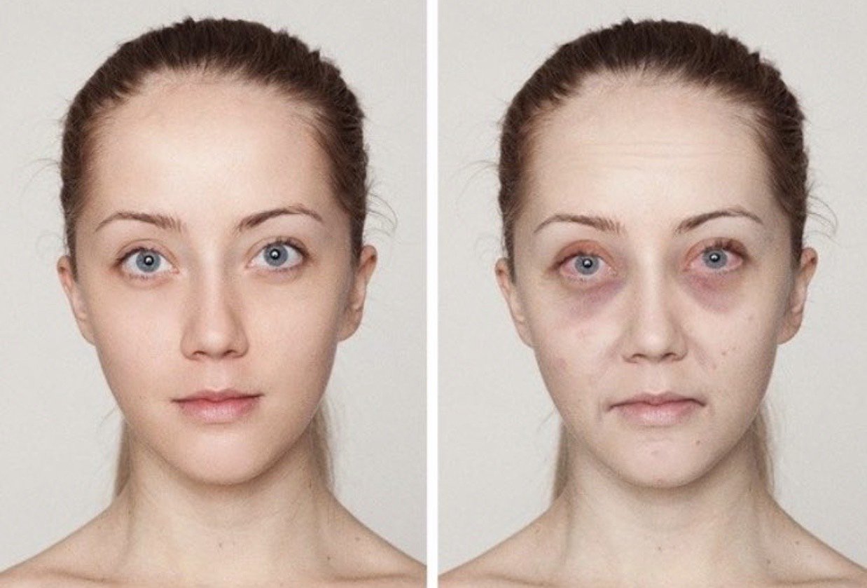 0599♀15国外网友通过化妆模拟"睡眠不足面容",揭秘_圈子-新氧