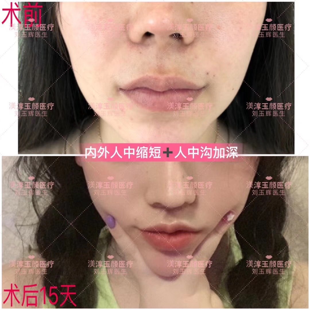 新氧,新氧网