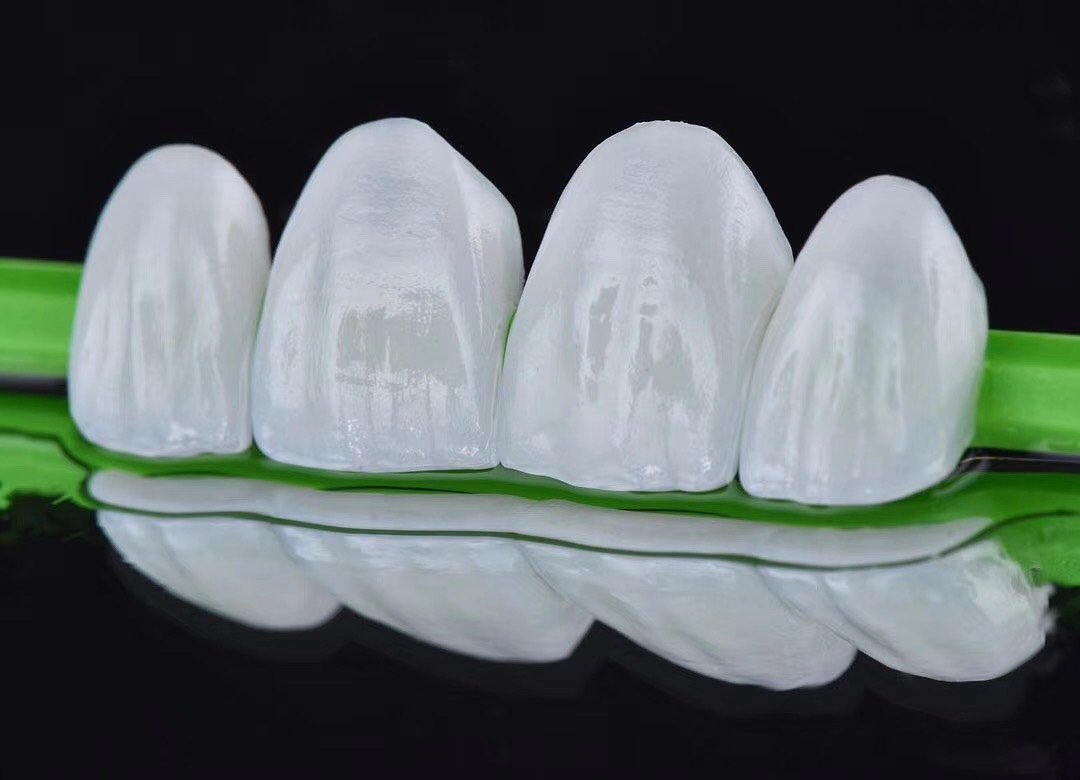 唇红齿白的诱惑,全瓷贴面,你,值得拥有