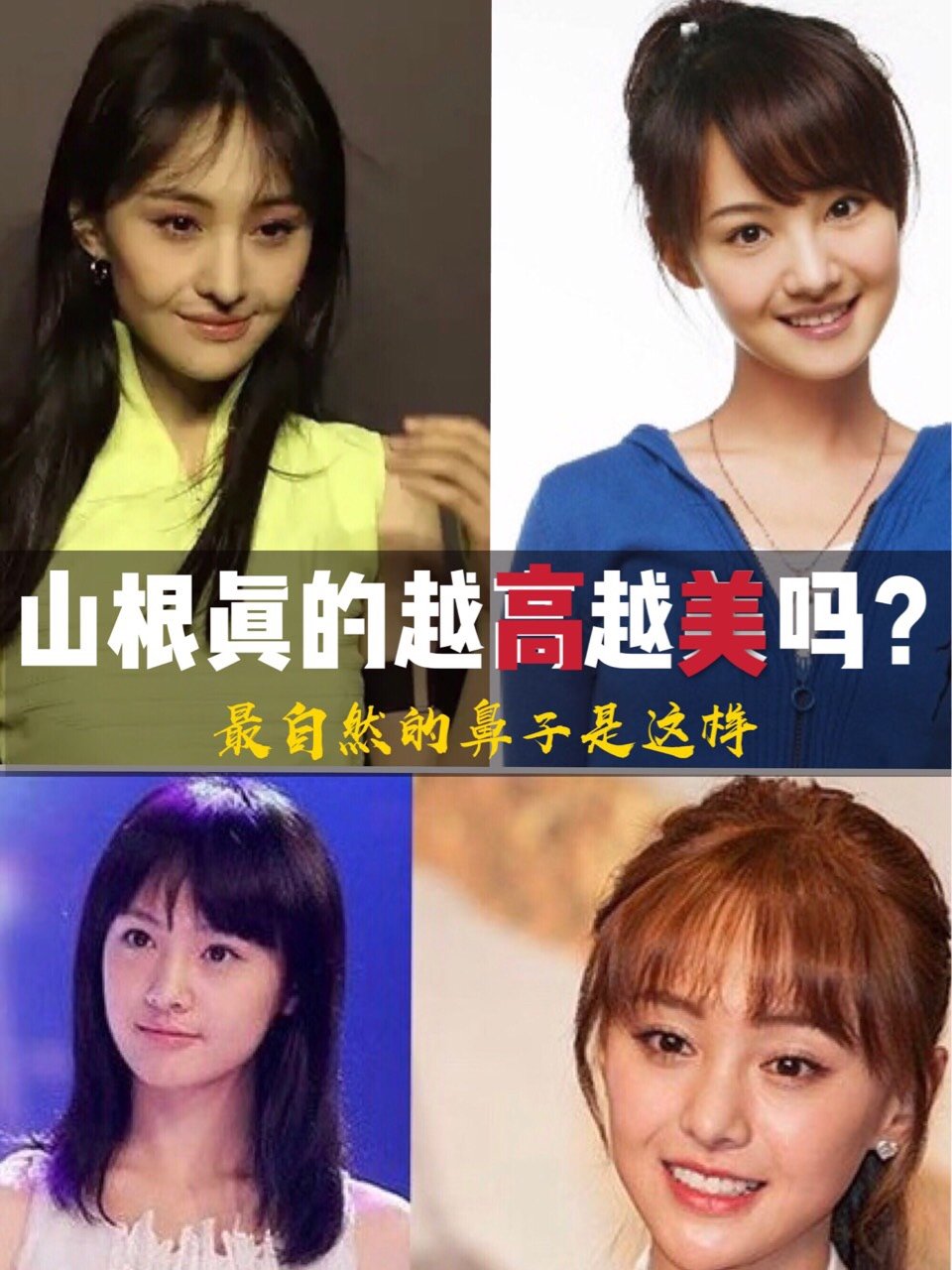 鼻梁真的越高越好吗 首先垫高山根对面部的影响 1 圈子 新氧美容整形