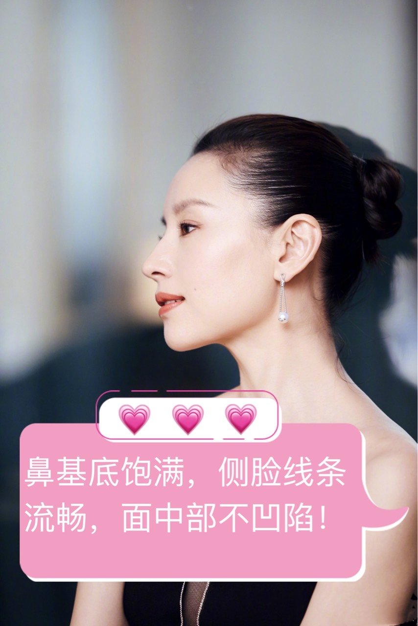 鼻基底的应该怎么整呢?