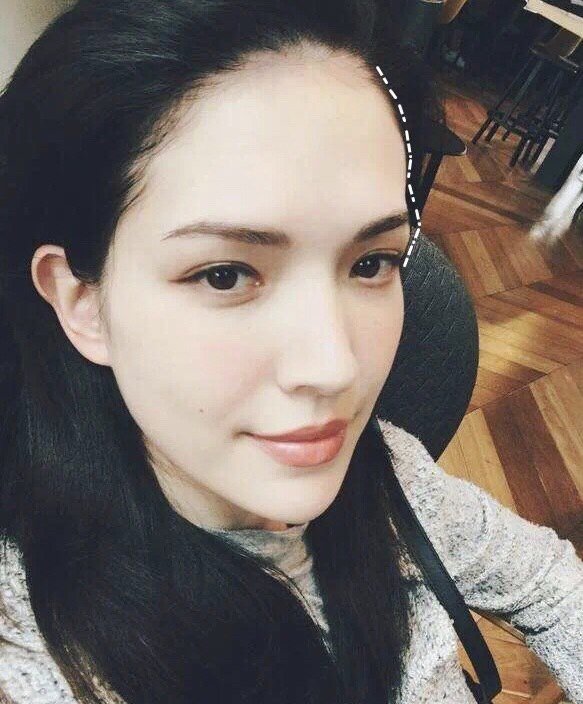 眉骨它位于额部下方,是额结节与眶上缘平行的弓形隆起_圈子-新氧美容