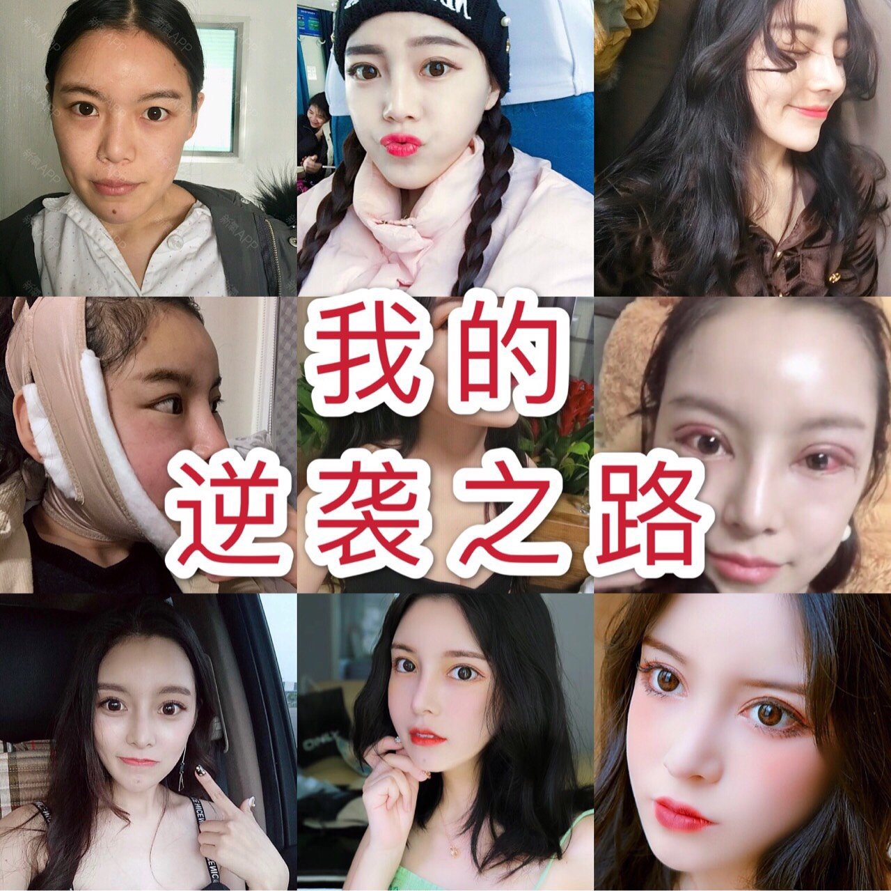 小美灿儿的人生课堂 开课啦 开始做整形以 圈子 新氧美容整形