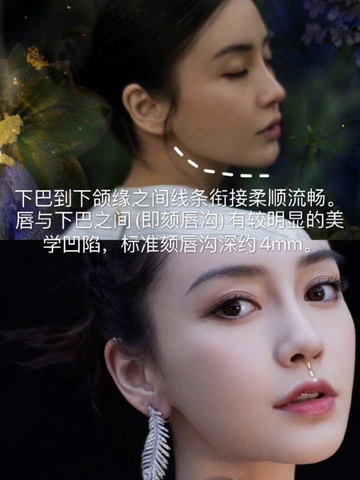 下巴也有"黄金"法则——隆下巴手术方式最全解析