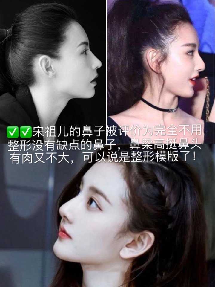 女明星們的名品鼻型———為你打造完美鼻型做好攻略.