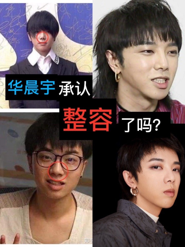 华晨宇有没有整容999999现在一说起花花华晨宇,那肯定_圈子