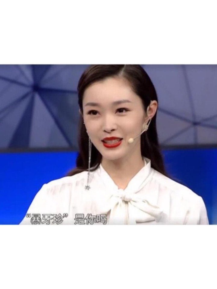 有种整容叫宋轶,矫正牙齿后美到认不出