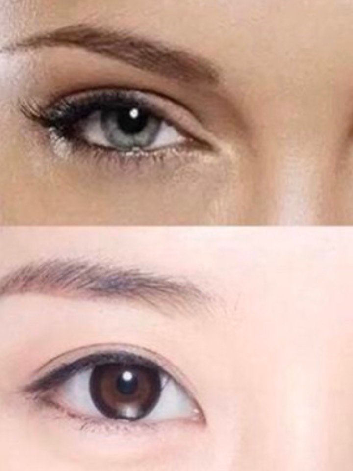 一般有双眼皮有四种类型