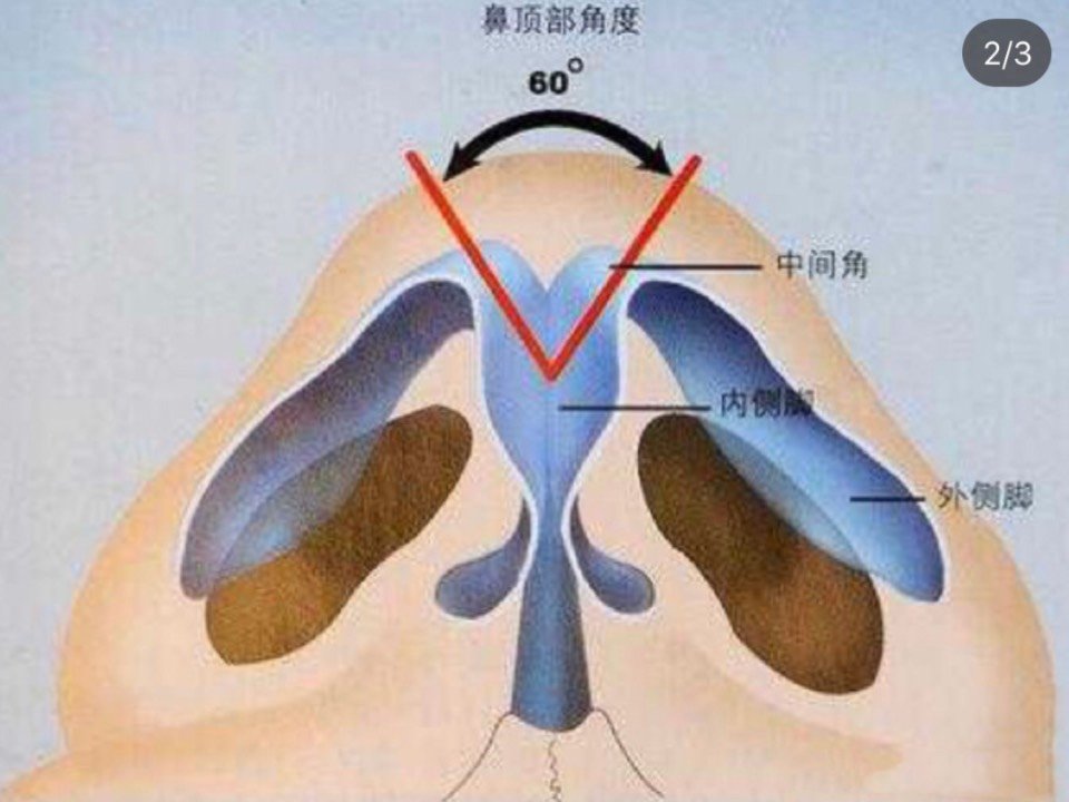 最美面孔大赛 你做完鼻整形为什么会出现鼻塞?