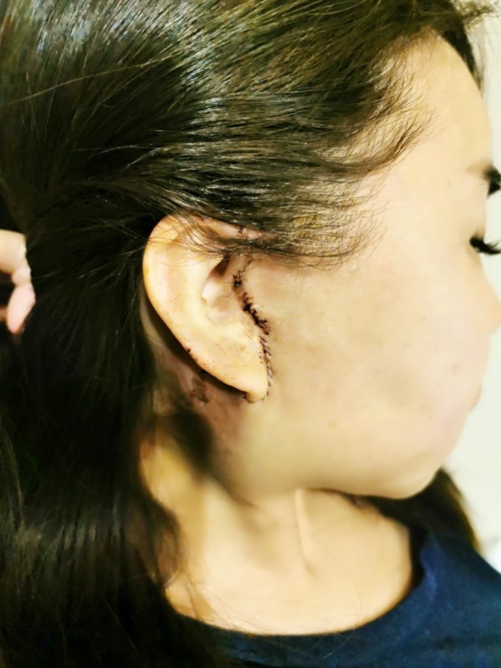 童颜babay