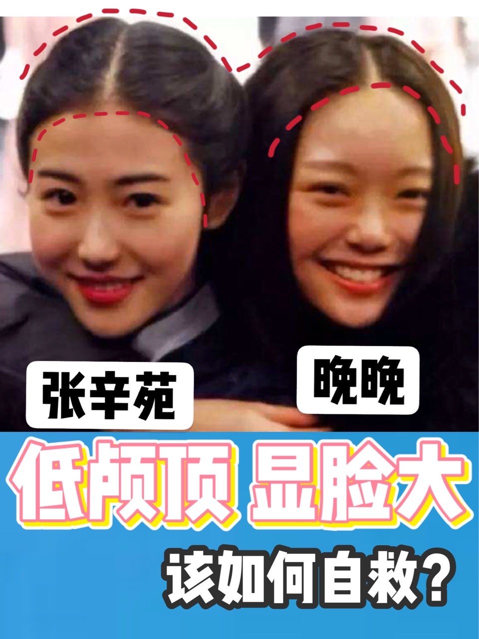 10个女生8个颅顶低