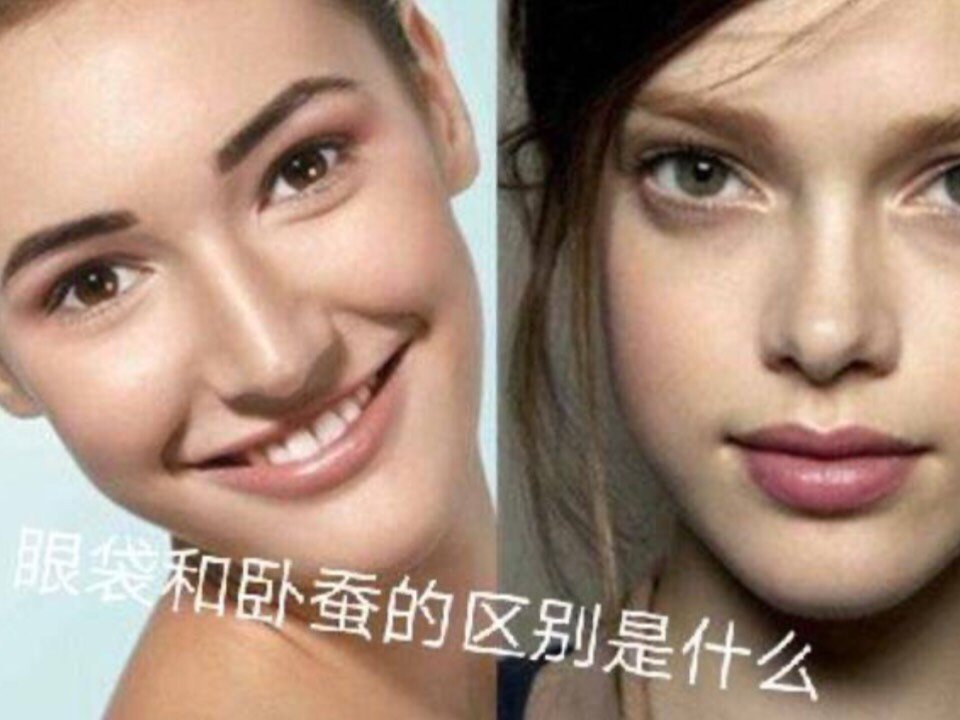 眼袋和卧蚕的区别是什么