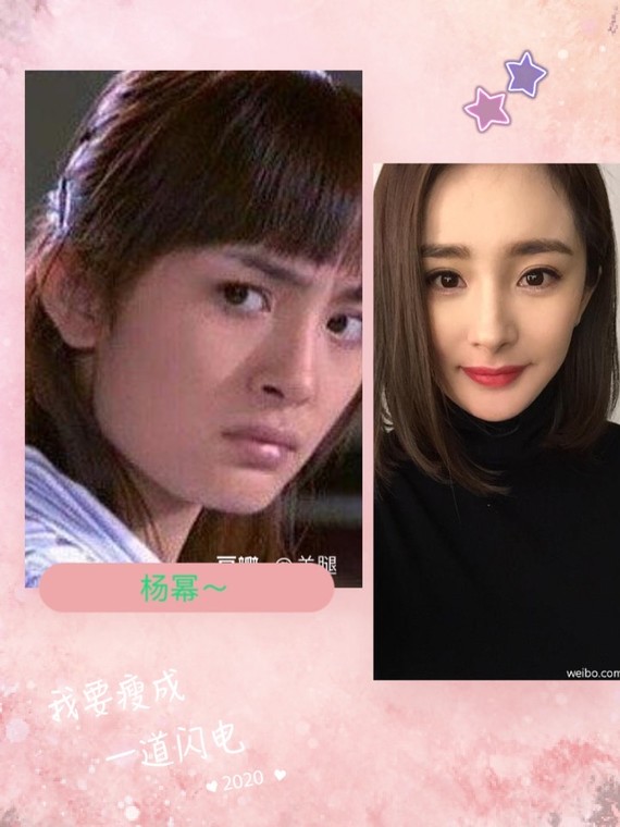 杨幂_圈子-新氧美容整形