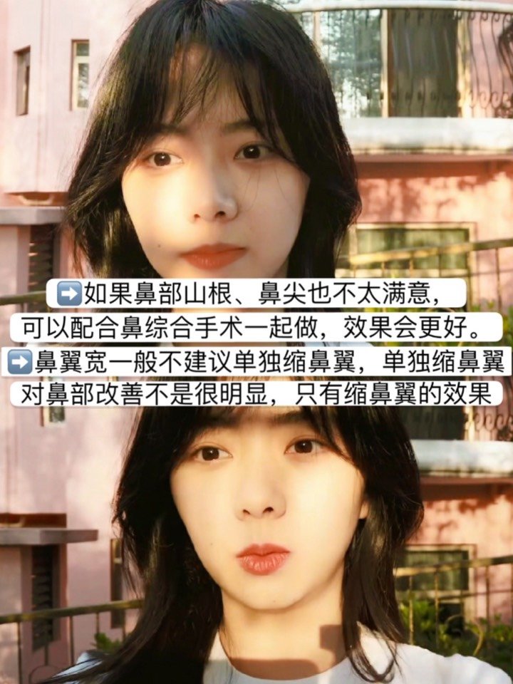 还有一种为鼻翼宽,也会感觉鼻部塌,鼻孔会显大,鼻部感觉蠢钝之感.