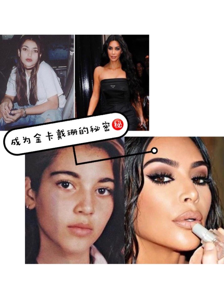 成为金卡戴珊!从丰唇开始.