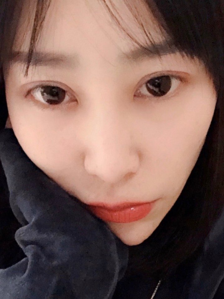 眼睛恢复的越来越好看了,形态越来越自然了,和以前没做双眼皮