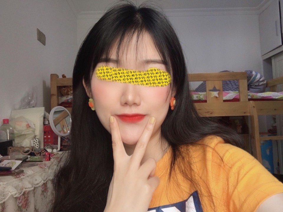 硅胶垫下巴私信领红包上门礼韩式生科假体丰下巴进口假体改善短下巴嘴