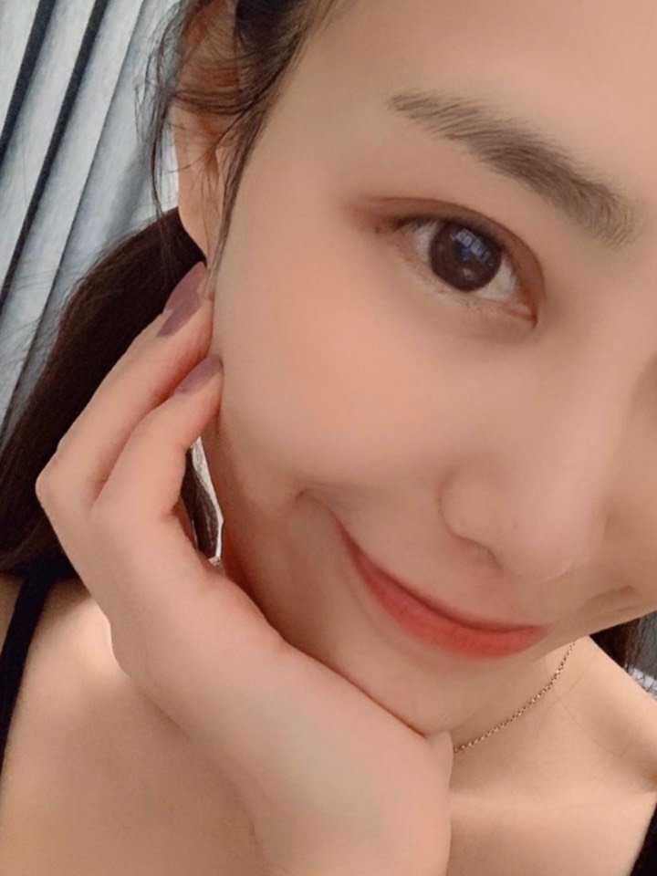 眼睛恢复的越来越好看了,形态越来越自然了,和以前没做双眼皮