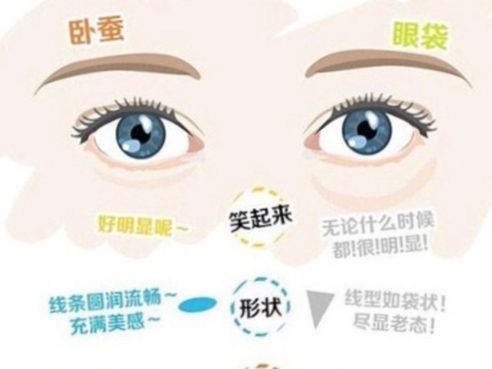 卧蚕和眼袋傻傻分不清楚 看完这篇文章你就知道了 圈子 新氧美容整形