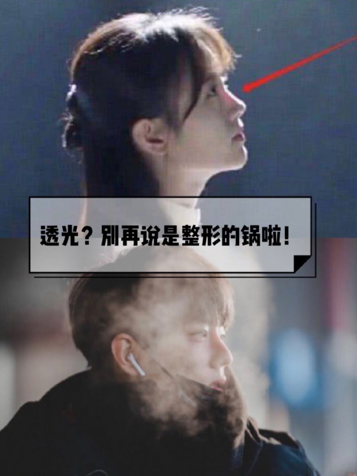 鼻子透光,别再一口咬定是整形的错
