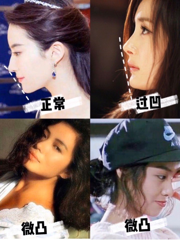 都说凸面无美女?其实美人需要"三分龅"