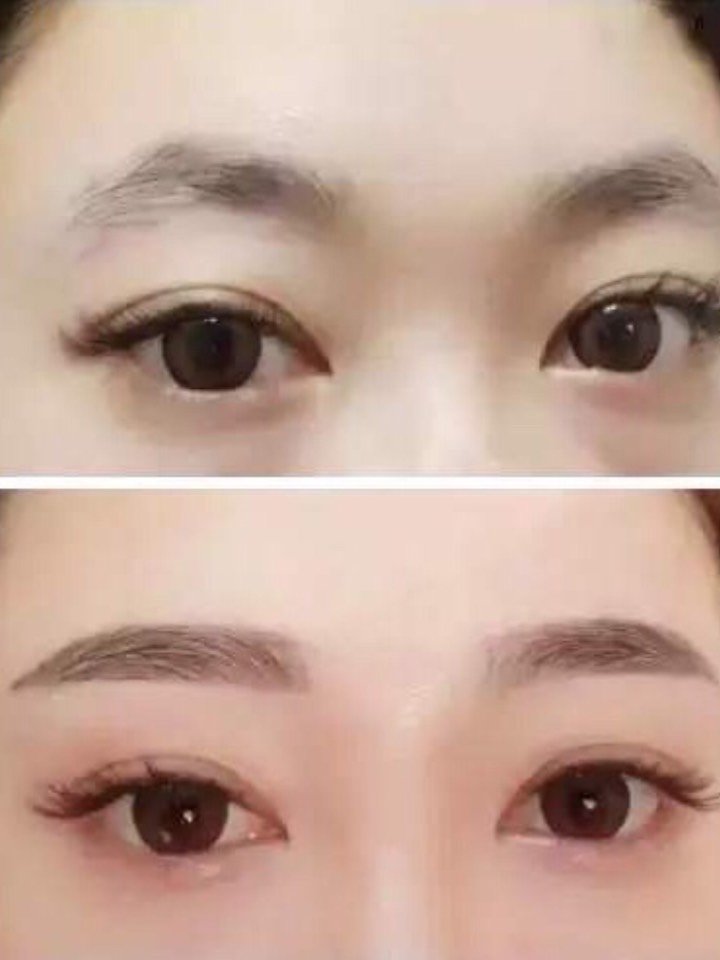 半永久纹眉后566大注意事项需警惕60