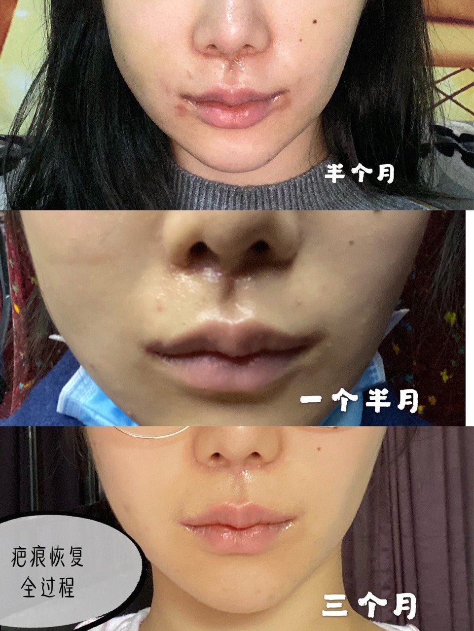 亲身经历72整形真理366566句