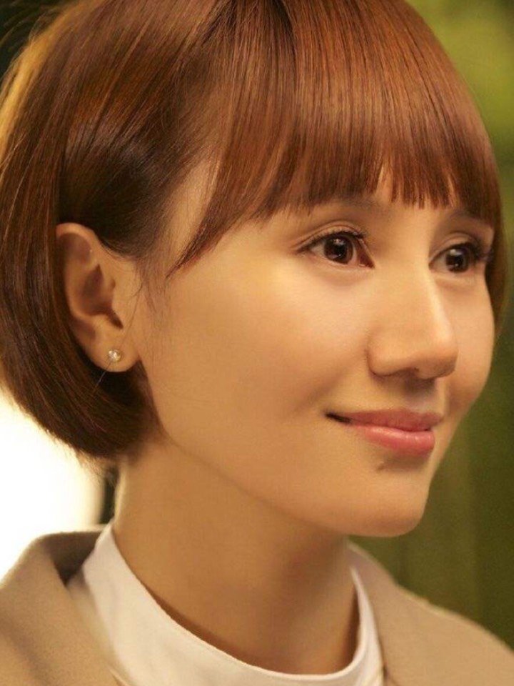 諅5款最常见的双眼皮类型,你适合哪一类