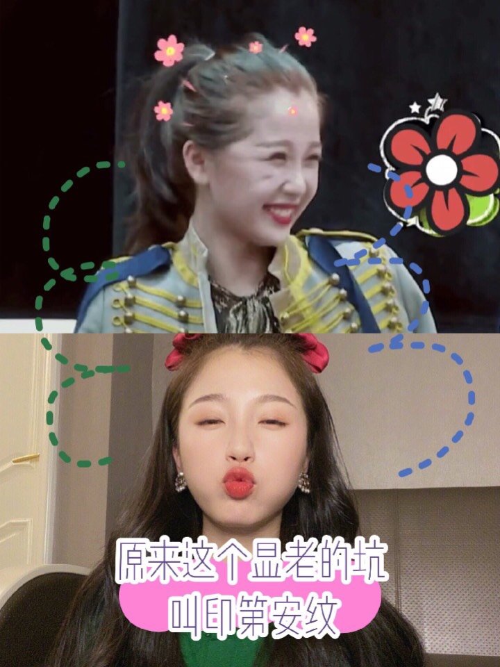 虞书欣#笑起来脸_圈子-新氧美容整形