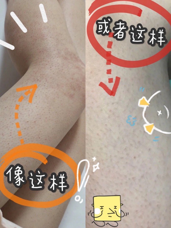 鸡皮肤用药之后化脓了(鸡皮肤用药之后化脓了怎么办)