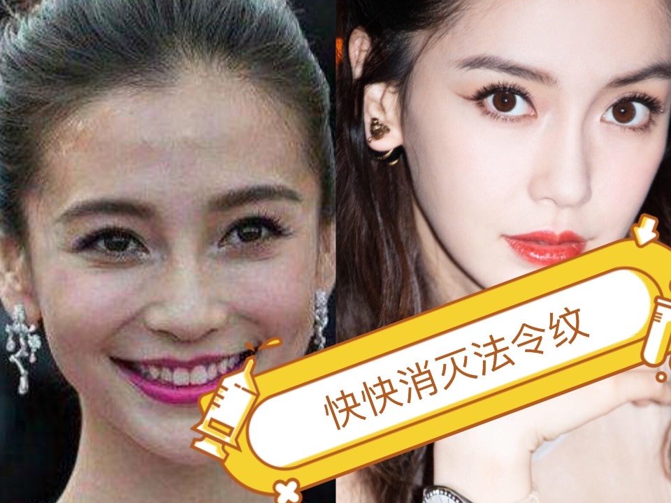 有了法令纹感觉老几岁