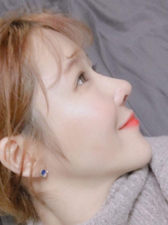 鼻尖不挺,单眼皮,侧脸就不是那么好看,周围的朋友经常劝我去做下鼻子