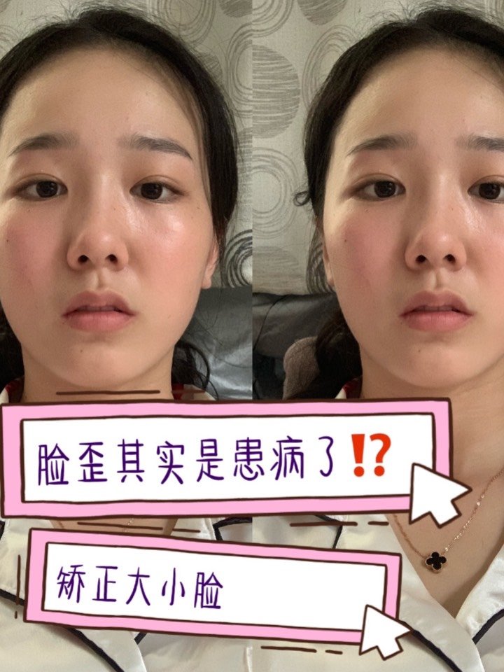 脸歪,大小脸你可能是患病了