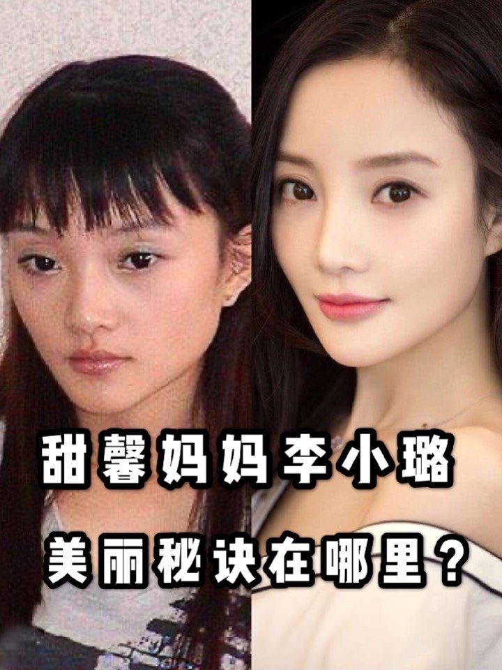 (图二)这张照片是李小璐20岁左右的照片,脸型是扁平的大饼脸,眼睛