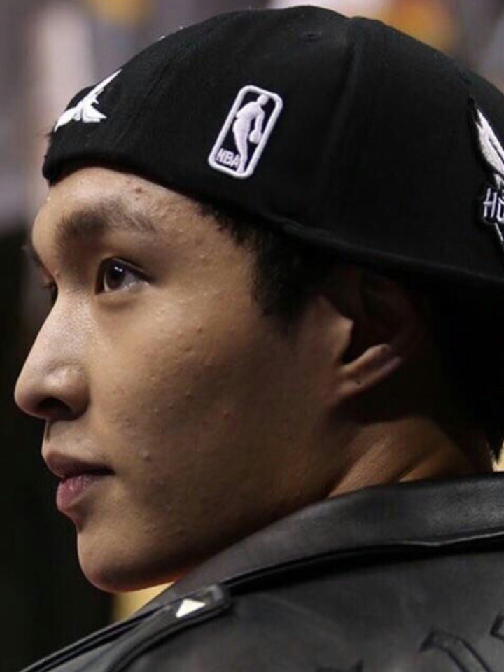 明星都逃不过高清镜头,张艺兴都有了痘痘怎么针对治疗呢?