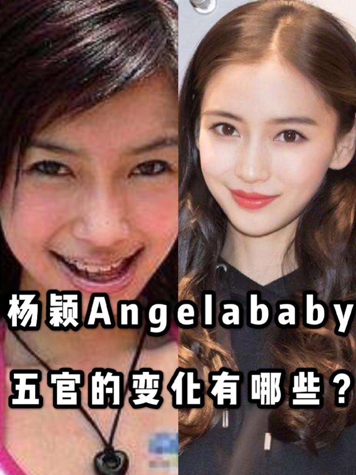 78要说辣妈行列,怎么能少了angelababy杨颖_圈子-新氧美容整形