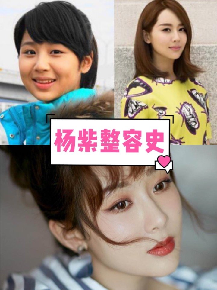 93童星出身的杨紫近日因在《青云志》扮演陆雪琪遭网友_圈子-新氧