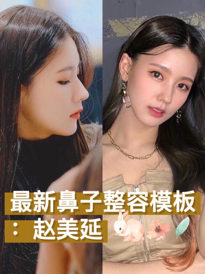 最新鼻子整容模板赵美延