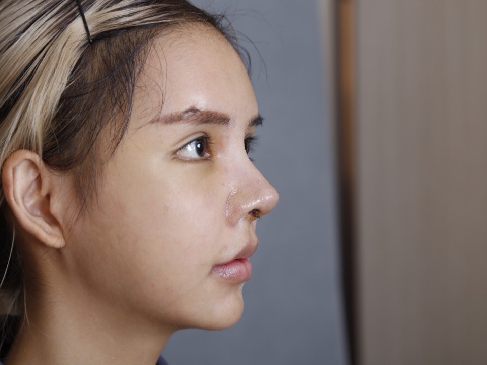 关于眉弓你知道哪些?