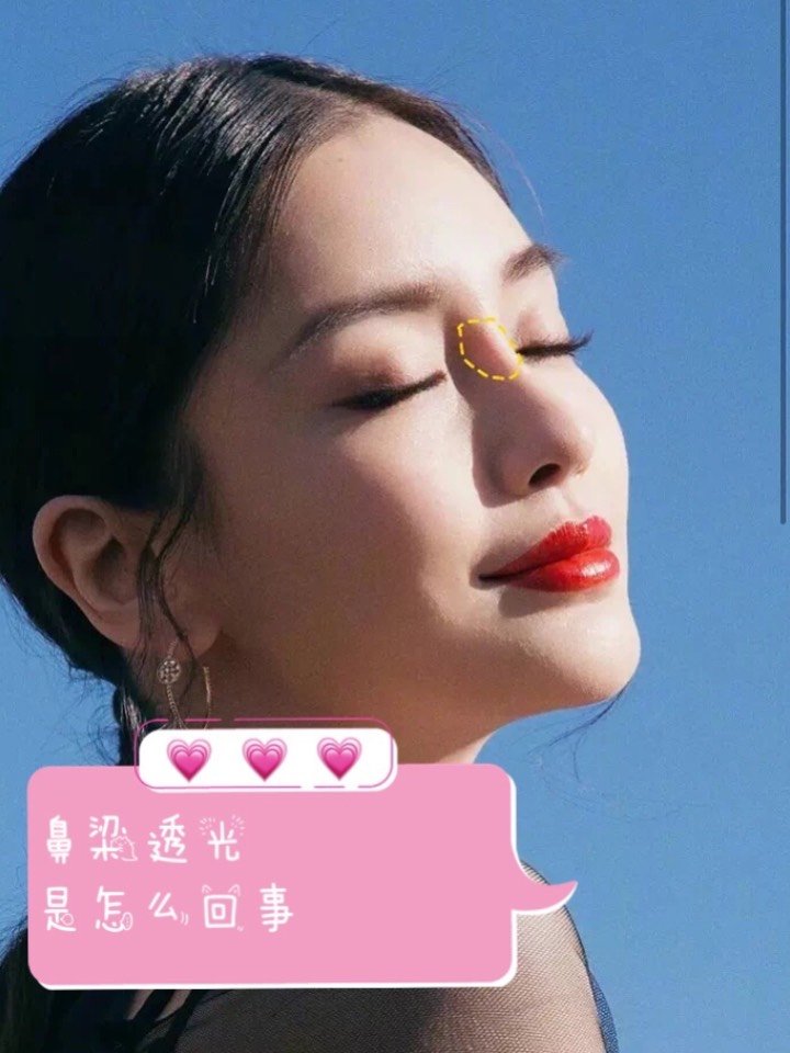 鼻梁透光是怎么回事