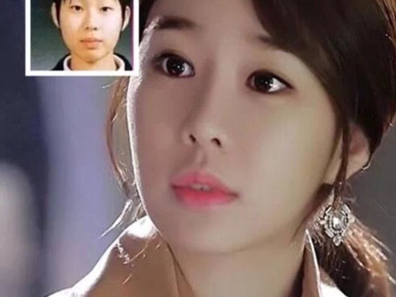 众所周知,韩国和日本都是名副其实的整形大亨,但是在_圈子-新氧美容