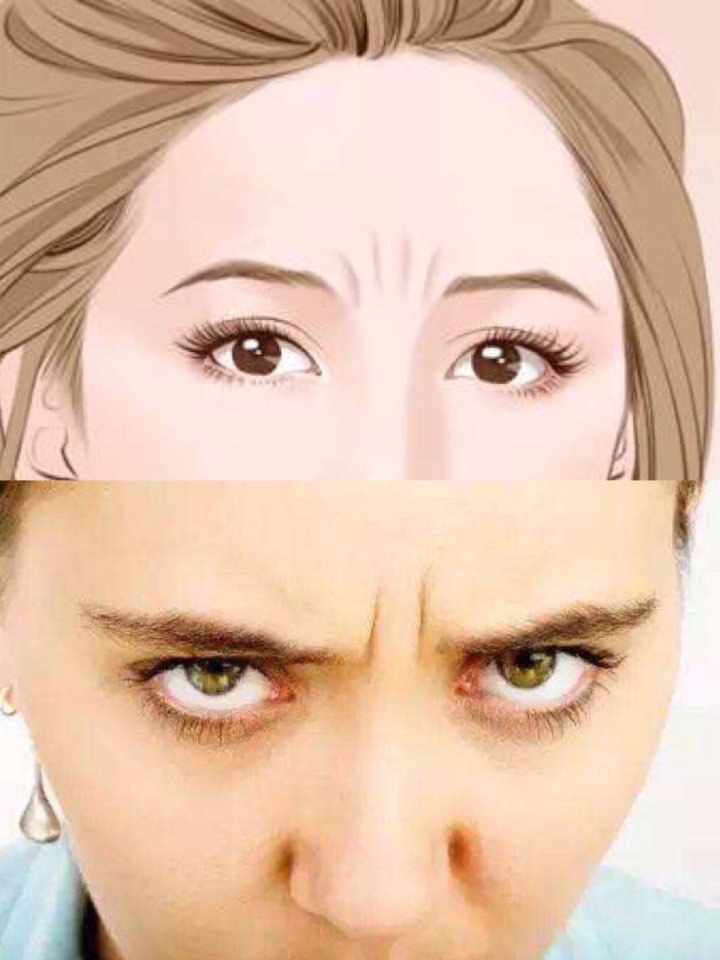 经常皱眉的人小心长出眉间纹