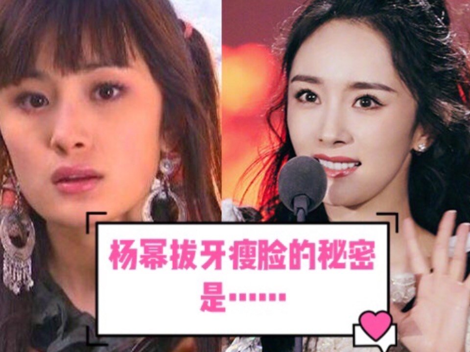 杨幂拔牙瘦脸的秘密是