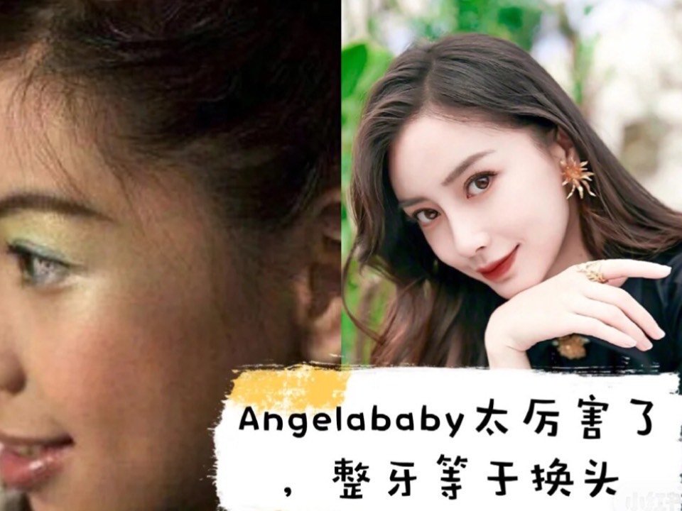 整牙真的等于整容?看看baby的成功秘诀